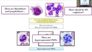 Patients Course Heme Macrocytosis Key Derivatives and embedded questions Part 1 [upl. by Behl]