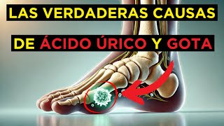 🤯 Las Causas Secretas de la Gota y el Ácido Úrico ¡Evítalo AHORA 💧🦶 [upl. by Gruver635]