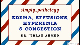 GENERAL PATHOLOGY II EDEMA EFFUSIONS HYPEREMIA CONGESTION II CHAP 4 II ROBBINS 10TH EDITION [upl. by Warp]