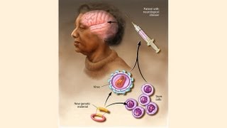 Human gene therapy types of gene therapy part 3 [upl. by Reider]