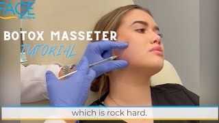 How to Inject Botox to the Masseter Muscles [upl. by Oileduab]