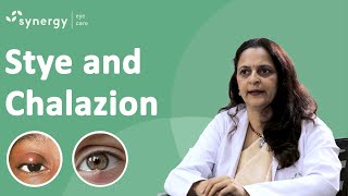 What is a Stye What is a Chalazion Whats are the causes and how can we prevent it [upl. by Gabbie374]