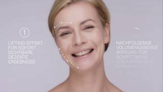 Fadenlifting – Sanftes Facelifting in der Sophienklinik mit Fäden von Silhouette™ [upl. by Efal]