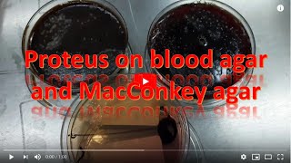 Proteus growth on blood agar and Macconkey agar [upl. by Watkin]