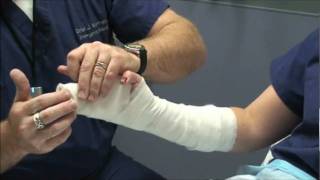 Splint Workshop 3  Ulnar Gutter Splint [upl. by Koralle]