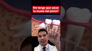 🦷MUELAS DEL JUICIO se necesitan sacar 🤔 Muelas del juicio [upl. by Etnod]