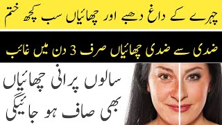 Chaiyon Ka ilaj  Chehre Ki Chaiyan  Pigmentation Ka ilaj  Get Rid Of Pigmentation  Desi Tips 10 [upl. by Nanaj]