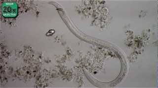 Nematode  Necator Americanus [upl. by Hochman]