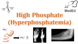 High Phosphate Hyperphosphatemia Dietary Sources Causes Symptoms Treatment [upl. by Sharlene]