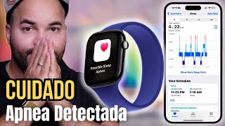 Apple Watch 10 Como Detecta la Apnea del Sueño [upl. by Maddox]