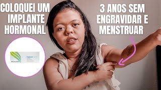 COLOQUEI UM IMPLANTE HORMONAL E QUASE DEU ERRADOMÃE COM NANISMO [upl. by Ecaroh78]