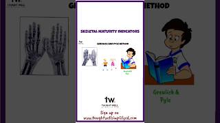 Greulich and Pyle Method shorts dentistry [upl. by Oates257]