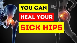 LIVE  Natural Solutions to Prevent amp Treat Hip  Miracle VITAMIN That Heals SICK HIPS viralvideo [upl. by Theron]