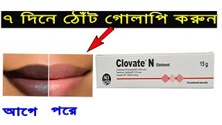 Clovate N Ointment Review Bangla । Benefits Uses Price Side Effects  ToTo Company BD [upl. by Roede830]