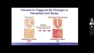 Cardiology Grand Rounds  Michael Alexanian PhD  9623 [upl. by Meek323]