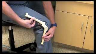 Canine ACL Tears and Anatomy discussed by Dr Bauer DVM DACVS [upl. by Elohc]