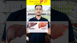 Fatty Liver Disease And Homeopathic Treatment Early Warning Liver Damagefatty liver doctor lft [upl. by Arlan]