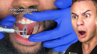 What Dentists DONT Tell You About Your Teeth [upl. by Mcnally]