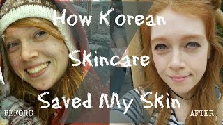 How Korean Skincare Saved My Skin  Living In Korea  Madi Miso [upl. by Nnylassej]