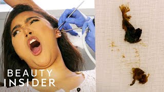 How Earwax Is Professionally Extracted  Beauty Explorers  Insider Beauty [upl. by Nnybor]