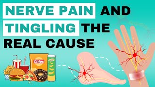 Real Cause Of Nerve Pain And Tingling [upl. by Etnohc]