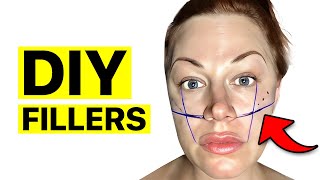 DIY Cheek Filler How I Did Cheek Filler At Home  Surgeon Reacts [upl. by Ilonka]