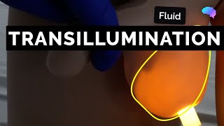 Transillumination  Scrotal Examination  OSCE Guide  UKMLA  CPSA [upl. by Lehteb]