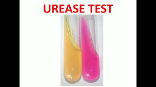 10 Urease Test MLTLectures [upl. by Errick]