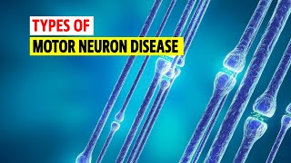 Types of Motor neuron disease [upl. by Oidivo]