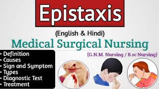 Epistaxis ent lecture  Epistaxis in hindi  Nosebleed [upl. by Colline]