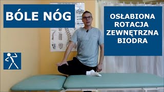 Ból nóg  ważna przyczyna  osłabiona rotacja zewnętrzna biodra [upl. by Ertha]