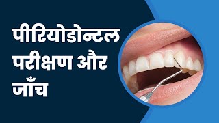 पीरियोडोन्टल परीक्षण और जाँच  Periodontal Examination and Probing in Hindi [upl. by Enyehc]