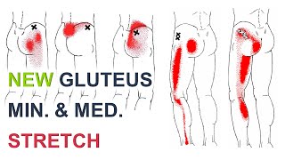 Stretches For Hip And Leg Pain  Gluteus Medius Pain [upl. by Northway]