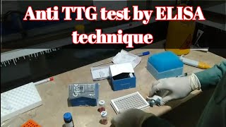 Procedure of Anti TTG tissue transglutaminase test IgG amp IgA by Elisa Technique [upl. by Dnamron]