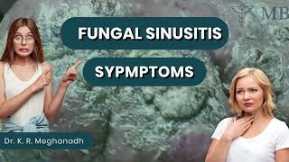 Fungal sinusitis symptoms  Dr K R Meghanadh  Medyblog [upl. by Bret]