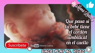 CORDON UMBILICAL ENREDADO EN EL CUELLO DEL BEBE [upl. by Bachman202]