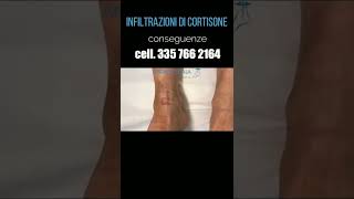 Effetti collaterali delle infiltrazioni di cortisone in ortopedia  Dott Andrea Scala  shorts [upl. by Haroun]