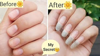 How to Grow Nails in 1 Week😍 Nail Growth Remedy for Short Nails  How to Whiten Nails [upl. by Katee]