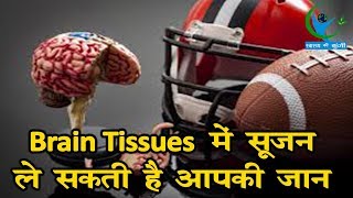 Brain TB Brain Tissues में में सूजन आ जाने से होती है यह गंभीर बीमारी जानें कैसे करेंगे इलाज [upl. by Ahtram432]