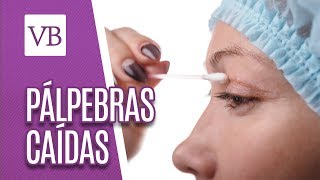 Pálpebras caídas  Você Bonita 290818 [upl. by Toomay]