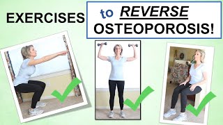 Reversing Osteoporosis Naturally Through Exercise – Best Exercises to Build Bone [upl. by Obadias893]