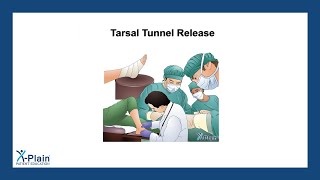 Tarsal Tunnel Release [upl. by Doownelg]