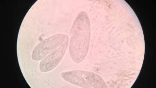 Paramesyumda konjugasyon Conjugation of paramecium [upl. by Thorstein]