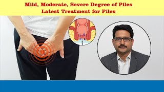 Treatment options for piles  Dr Sujay B R  Nano hospitals bengaluru [upl. by Norramic]