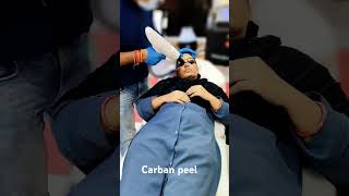 Carban peel treatment minivlog ytshort youtubeshorts manojdayshorts Noorikilife [upl. by Guevara]