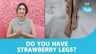 Strawberry Legs  How To Get Rid of Strawberry Legs [upl. by Lechner901]