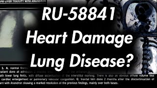 RU58841 Heart Damage and Lung Disease [upl. by Llohcin]