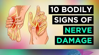 10 Signs of NERVE DAMAGE and How To Repair Nerves [upl. by Anoel]