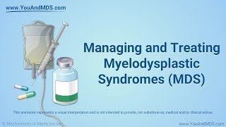 Managing and Treating MDS [upl. by Eylrahc]