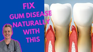 Fix Gum Disease Eat This To Cure Gum Disease [upl. by Jereld513]